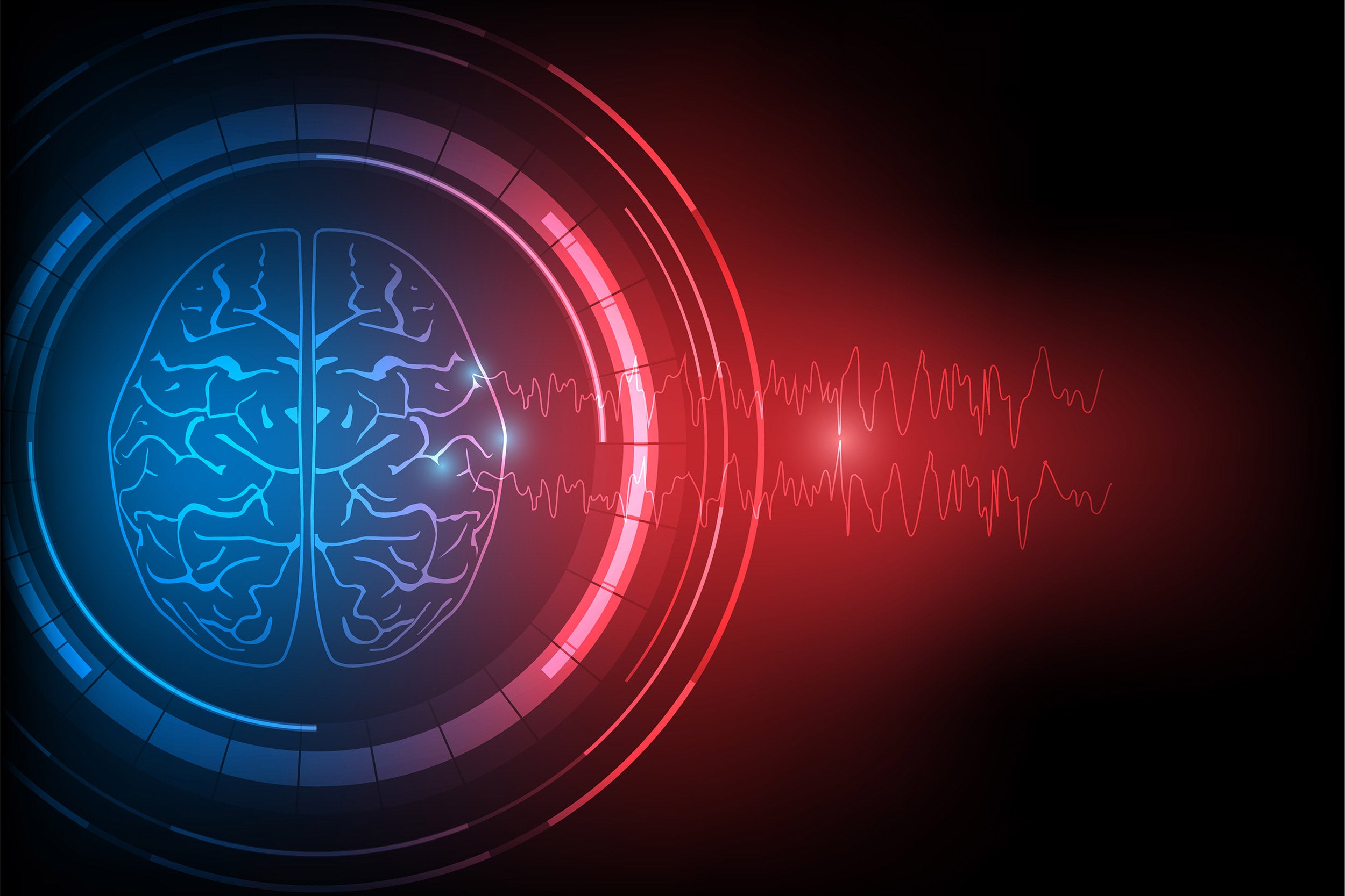 electroencephalography or EEG wave discharges